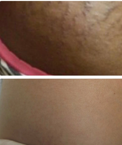 Elastin Stretch Mark Concentration freeshipping - World of Entertainment23